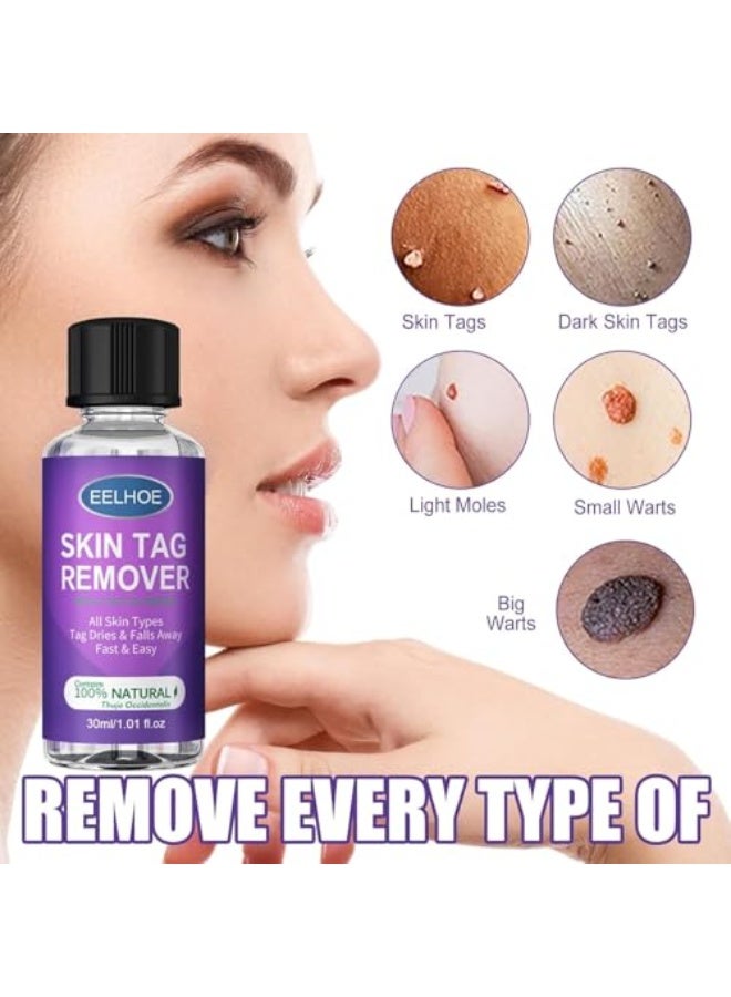 EELHOE Skin Tag Remover, Wart Remover Freeze Off, Fast-Acting Liquid Wart Removal for Plantar, Wart Corn Callus Remover 30Ml(1pcs) - Image 2