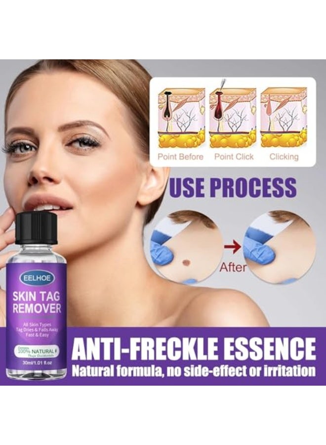 EELHOE Skin Tag Remover, Wart Remover Freeze Off, Fast-Acting Liquid Wart Removal for Plantar, Wart Corn Callus Remover 30Ml(1pcs) - Image 3