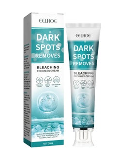 Freckle Whitening Cream, Remove Dark Spots, Melanin Pigmentation, Anti Aging, Brighten Melasma Lotion, Improve Melasma