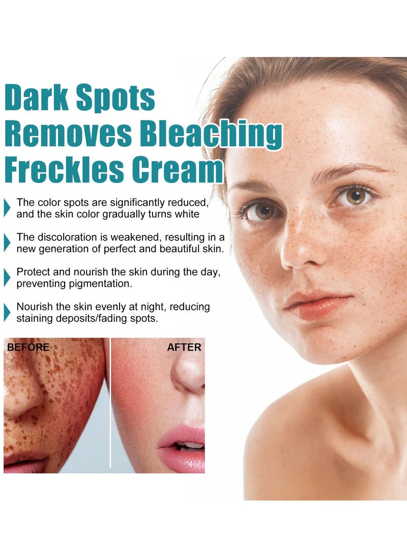 EELHOE - Freckle Whitening Cream, Remove Dark Spots, Melanin Pigmentation, Anti Aging, Brighten Melasma Lotion, Improve Melasma - Image 1