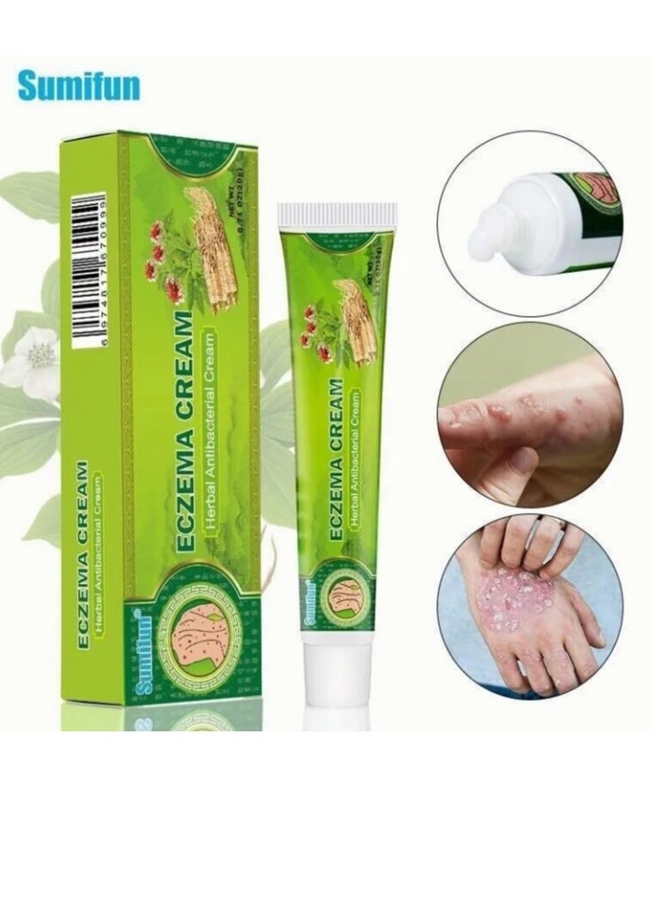 Eczema Cream Herbal Antibacterial Ointment 20g External Use - pzsku/Z9FDF8D324CEBB330CF21Z/45/_/1722339344/087048d5-fdac-4eef-b3e9-17131103b468