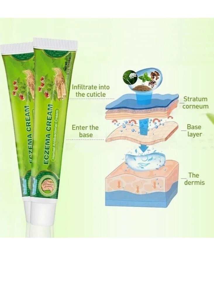 Eczema Cream Herbal Antibacterial Ointment 20g External Use - pzsku/Z9FDF8D324CEBB330CF21Z/45/_/1722339385/7850c051-9b09-4226-b40a-1028e2b64ca3