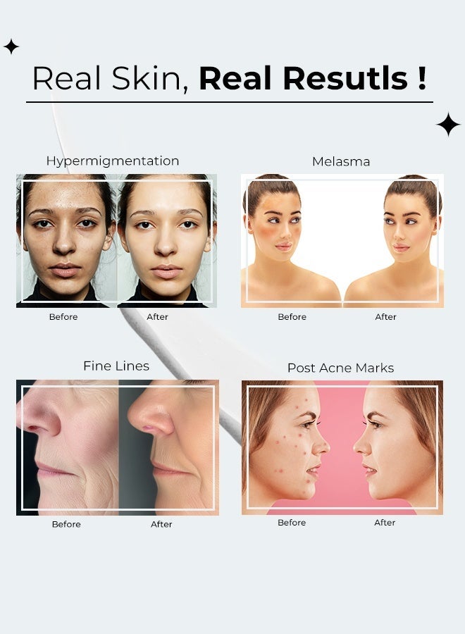 Muna Belleza Whitening Cream Face Moisturizer Day and Night Set for Melasma Pigmentation Dark Spots Anti-Aging with Niacinamide Arbutin Vitamin C All Skin Types 2 x 30g - Image 3