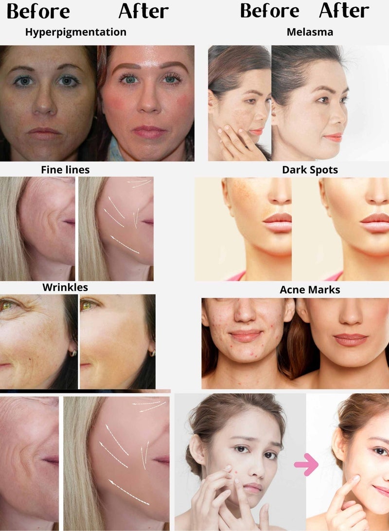 Muna Belleza Whitening Cream Face Moisturizer Day and Night Set for Melasma Pigmentation Dark Spots Anti-Aging with Niacinamide Arbutin Vitamin C All Skin Types 2 x 30g - Image 2