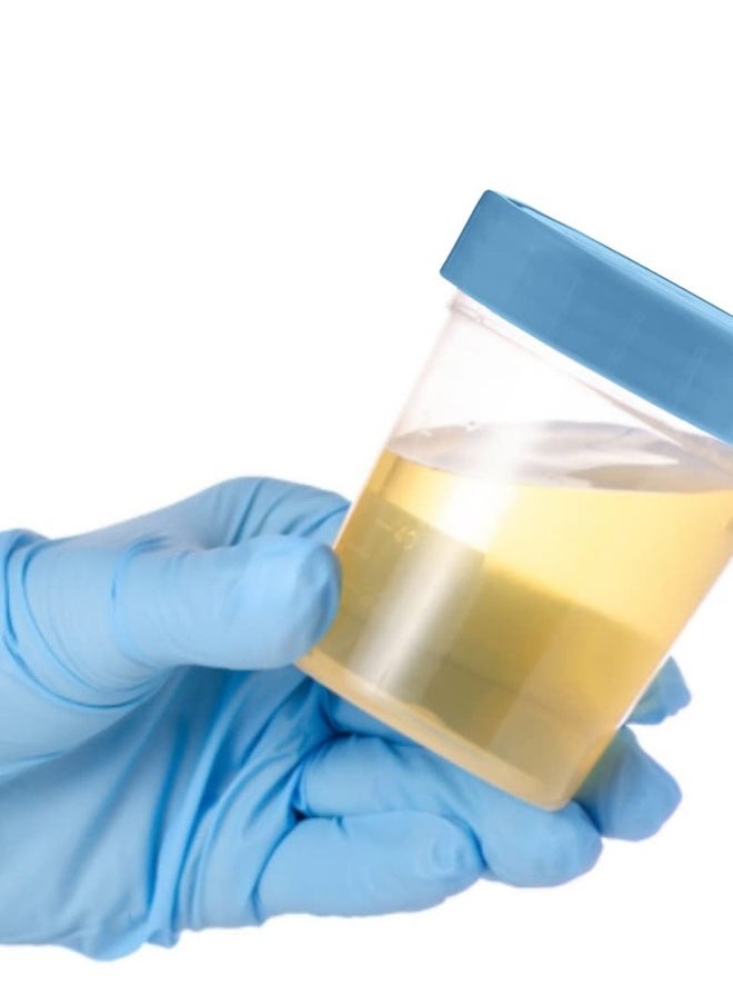 Vakly Specimen Cups with Leak Proof Screw on Lids - 4oz [Pack of 25] Clear Non-Sterile Urine Sample Jars - Containers for Safe Pee, Stool, Semen Sample Collection for Testing (25)  - Image 4