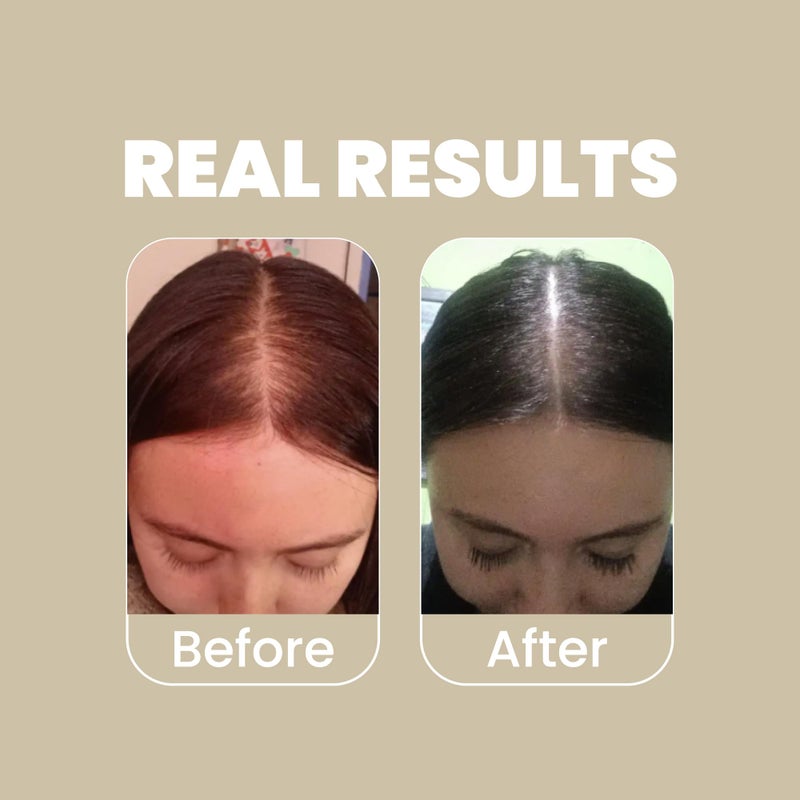 ANYELUZ Rosemary Shampoo and Conditioner Set - With Hyaluronic Acid and Natural Extracts, Strengthens and Hydrates Hair for Shine and Vitality - Â¡Tu Cabello Fuerte! - Image 5