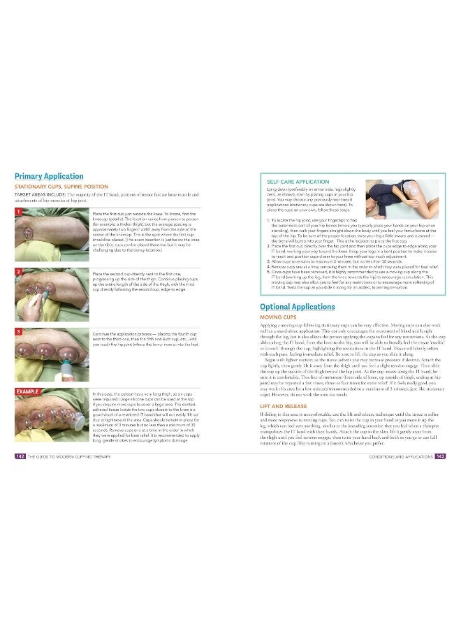 Guide to Modern Cupping Therapy: A Step-by-Step Source for Vacuum Therapy  - Image 5