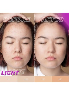 LAMEL Ohmy Clear Face Full Coverage Foundation Acne Coverage Salicylic Acid & Tea Tree Extract Dewy & Flawless Finish Sensitive Skin Care Organic & Oilfree 402 1.35 Fl.Oz  - Image 3