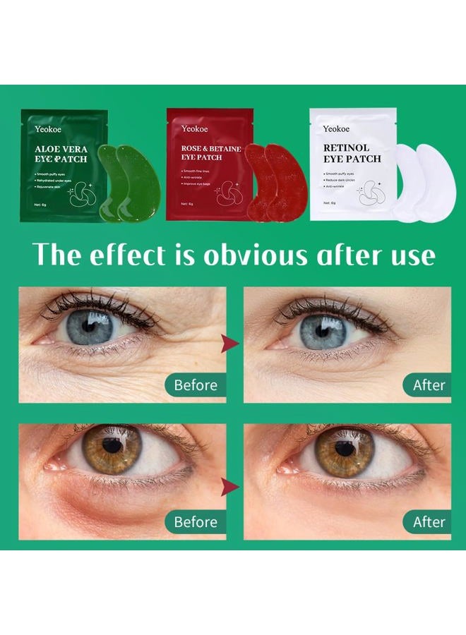 Yeokoe Under Eye Patches For Puffy Eyes and Dark Circles Wrinkle,30 Pairs Eye Masks Face Masks SkinCare With Retinol Serum,Aloe Vera,Rose & Betaine,Stocking Stuffers for Women - Image 4