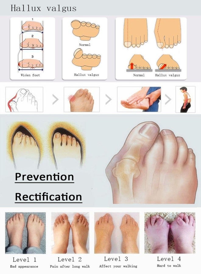 JERN Foot Care Toe Cushion, Hallux Valgus Toe Protector Gel Sleeve Toe Cushion Toe Braces Sock Metatarsal Strap (L) - Image 4