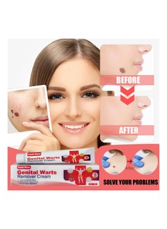 Genital  Wart And Skin Tag Remover Cream 20g