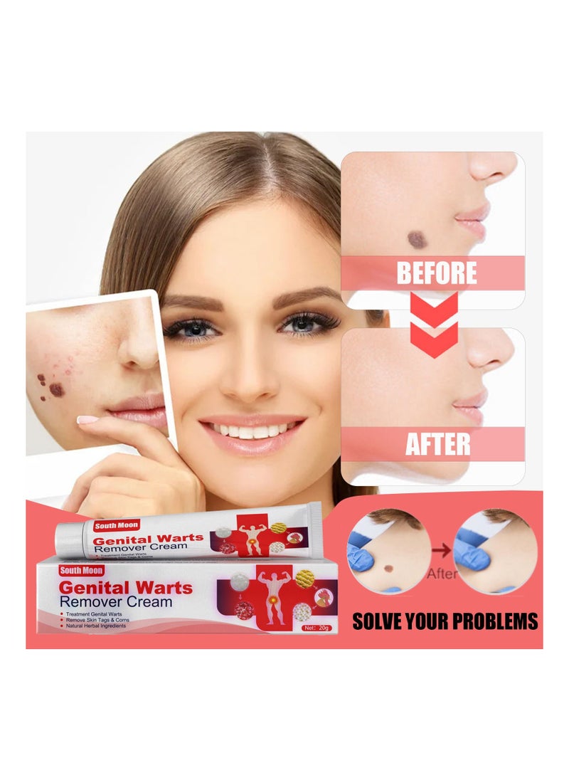 SOUTH MOON - Genital  Wart And Skin Tag Remover Cream 20g - Image 1