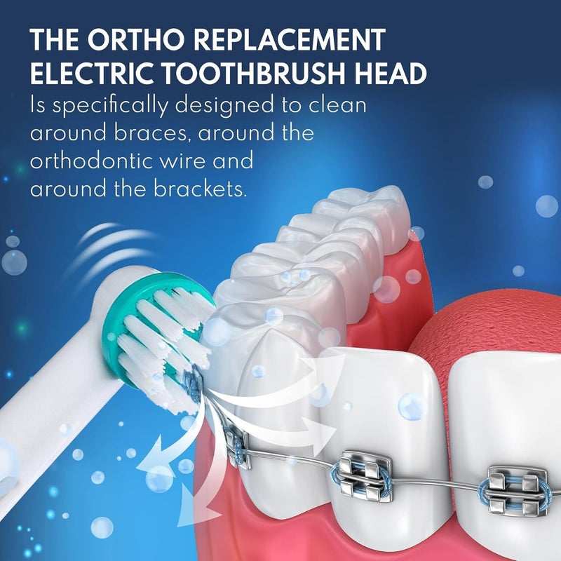 ألابينا رؤوس فرشاة بديلة لأداة Oral B Braun Professional Ortho Brush Head & Power Tip Kit - عبوة من 4 رؤوس فرشاة أسنان كهربائية تقويمية متوافقة، الجمعة السوداء، الاثنين الإلكتروني! - Image 3