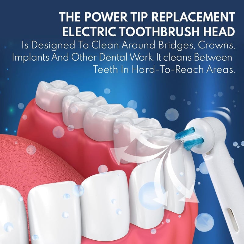 ألابينا رؤوس فرشاة بديلة لأداة Oral B Braun Professional Ortho Brush Head & Power Tip Kit - عبوة من 4 رؤوس فرشاة أسنان كهربائية تقويمية متوافقة، الجمعة السوداء، الاثنين الإلكتروني! - Image 4