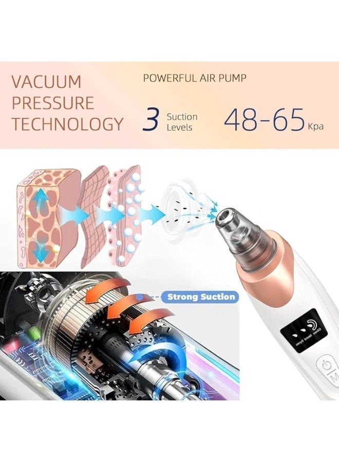 Blackhead Remover & Pore Cleaner Vacuum with Multiple Probes and Adjustable Suction Levels - Image 3