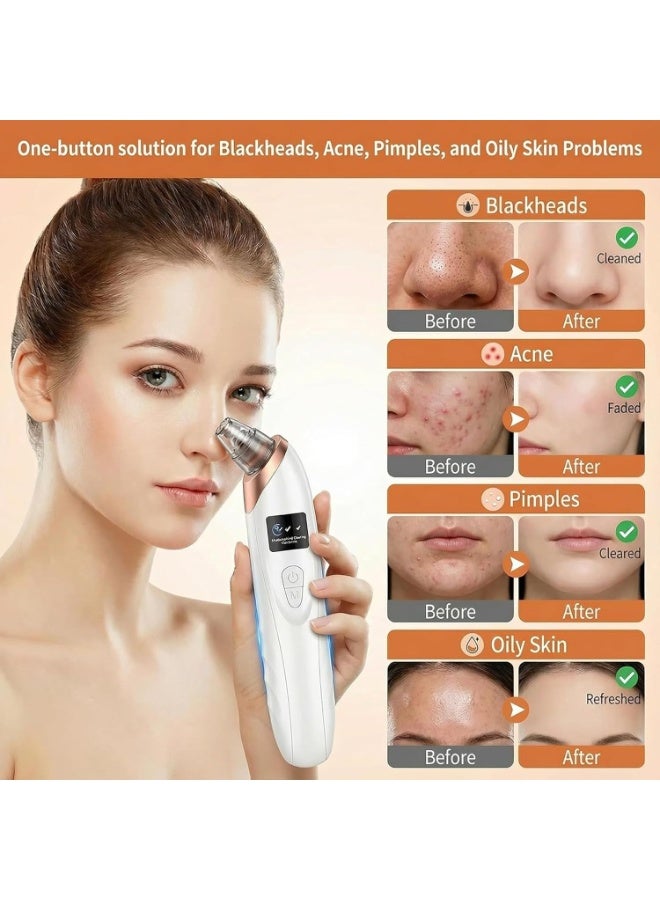 Blackhead Remover & Pore Cleaner Vacuum with Multiple Probes and Adjustable Suction Levels - Image 4