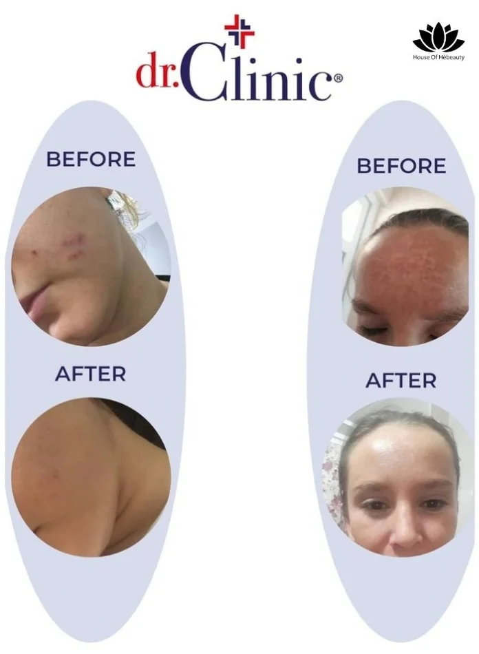 dr.Clinic Deep Corrective Whitening Cream