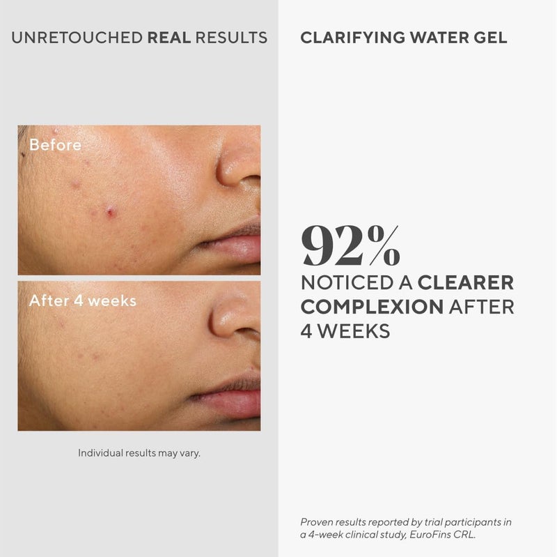 Murad Clarifying Water Gel - Lightweight Hydrating Acne Moisturizer with Salicylic Acid & Hyaluronic Acid - 50ml - Image 2