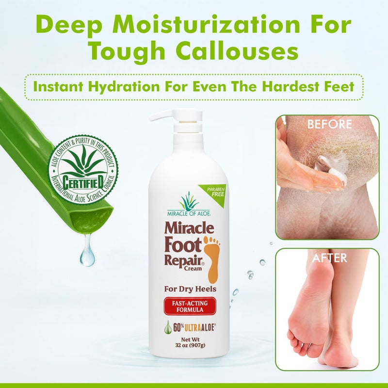 Miracle of Aloe Miracle Foot Repair Cream (32 oz) Repairs Dry Cracked Heels and Feet, 60% Pure UltraAloe Moisturizes, Softens, and Repairs - Image 3