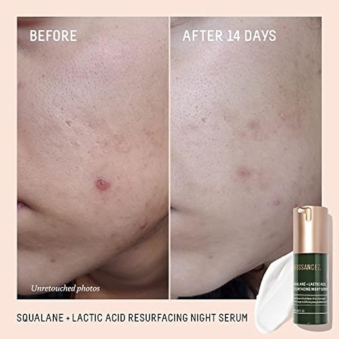Biossance Rapid Radiance Set - Image 4