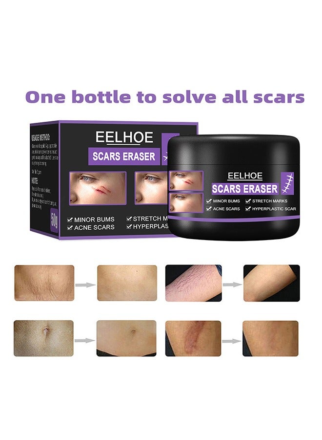 EELHOE Scar Eraser，Scar Removal Cream，Acne Scar Treatment，Deep Acne Scar Removal， Burns Keloids Hypertrophic， Repair Damaged Skin，Removing Acne Marks Scar Repair Cream ﻿50g - Image 3