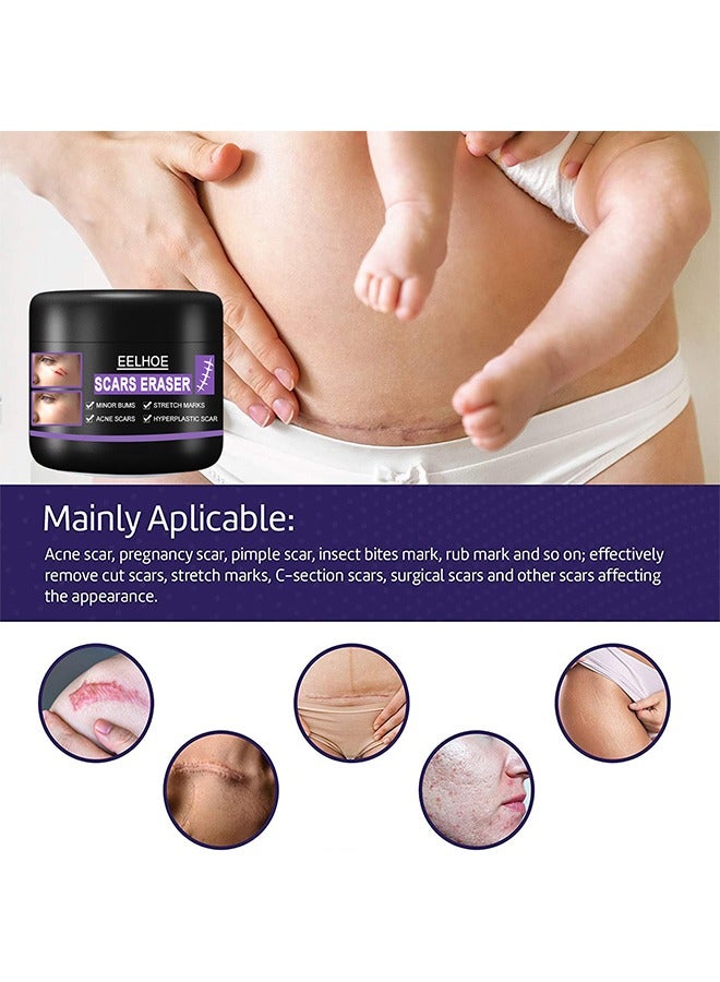 EELHOE Scar Eraser，Scar Removal Cream，Acne Scar Treatment，Deep Acne Scar Removal， Burns Keloids Hypertrophic， Repair Damaged Skin，Removing Acne Marks Scar Repair Cream ﻿50g - Image 4