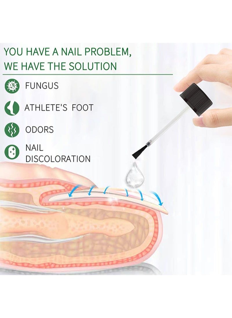 HEALMUSZ - Toenail Fungus Treatment Extra Strength - Fungal Nail Renewal Treatment for Toe Nail and Fingernails - Nail Repair Solution for Thick, Broken, Discolored Nails- Renews Damaged Cracked Ingrown Toenail - Image 1