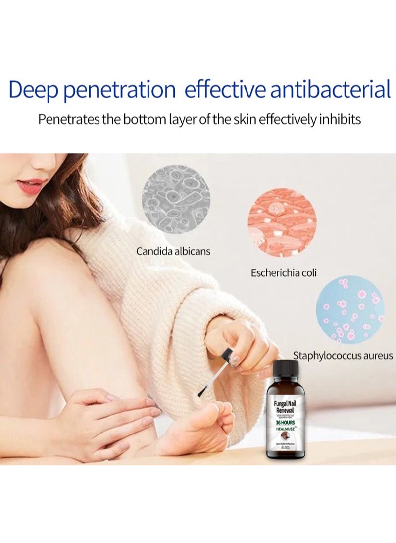 HEALMUSZ - Toenail Fungus Treatment Extra Strength - Fungal Nail Renewal Treatment for Toe Nail and Fingernails - Nail Repair Solution for Thick, Broken, Discolored Nails- Renews Damaged Cracked Ingrown Toenail - Image 1