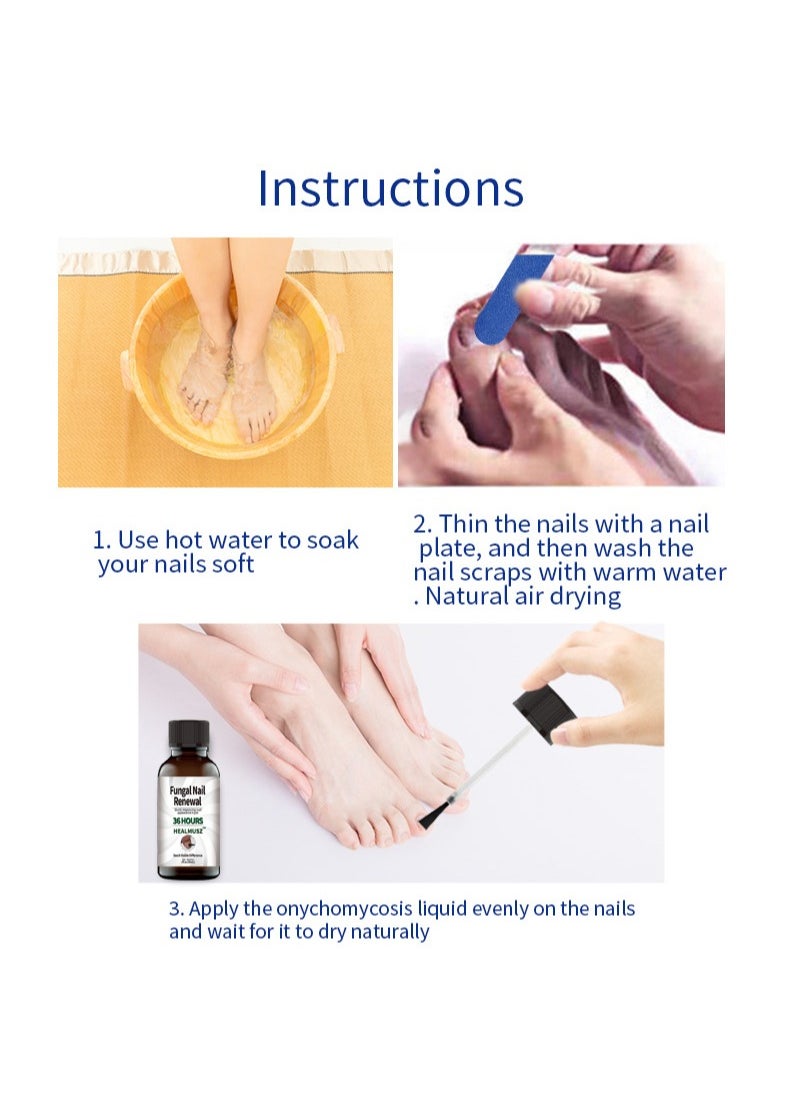 HEALMUSZ - Toenail Fungus Treatment Extra Strength - Fungal Nail Renewal Treatment for Toe Nail and Fingernails - Nail Repair Solution for Thick, Broken, Discolored Nails- Renews Damaged Cracked Ingrown Toenail - Image 1