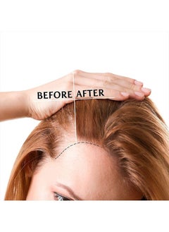 Luv Me Care Hair Growth Oil Hair Growth Serum for Thicker Longer Fuller Healthier Hair,Biotin & Castor oil & Rosemary Oil for Hair Growth, Prevent Hair Loss & Thinning, Women & Men, All Hair Types 1.7  - Image 2