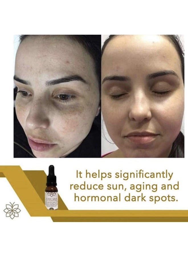 Class Gold Cosmetics - Tonico Aclarante Facial. Manchas e Imperfecciones. Clarifying Facial Tonic, Dark Spot and Blemish Remover from Aqua Labs Colombia - Image 1