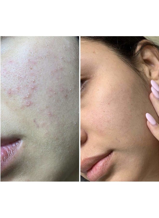 Class Gold Cosmetics - Tonico Aclarante Facial. Manchas e Imperfecciones. Clarifying Facial Tonic, Dark Spot and Blemish Remover from Aqua Labs Colombia - Image 1