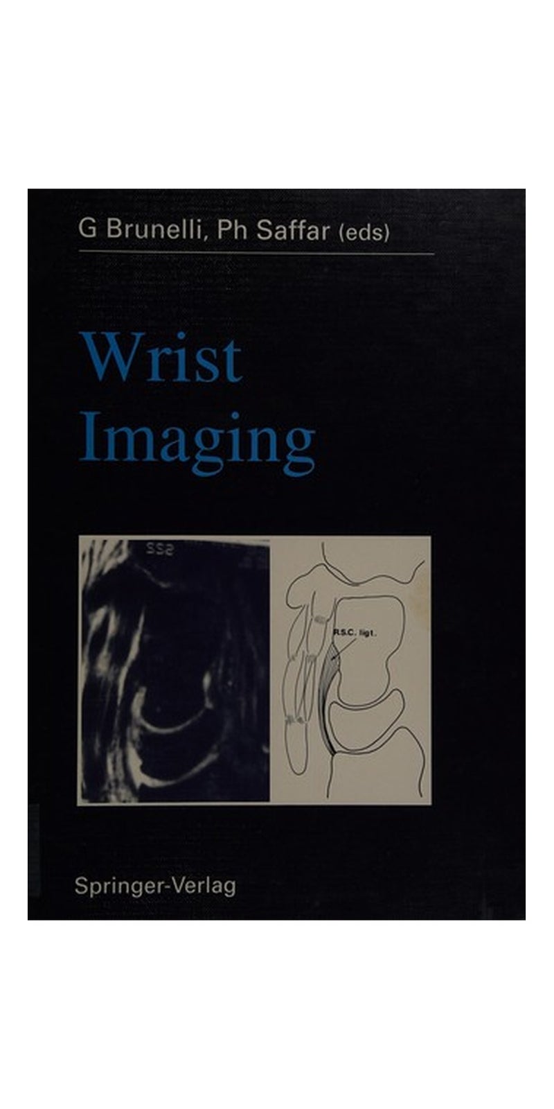 Wrist Imaging | Authored by Giorgio Brunelli | Hardcover | Published by Springer