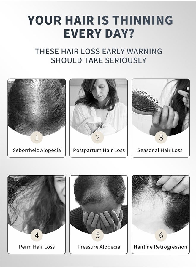 lansiyi - 20ml Hair Growth Essential Oil 5% Minoxidil and Biotin with Natural Herbal Extract for Women Men Hair Regrowth Hair Loss Hair Thinning Treatment - Image 1