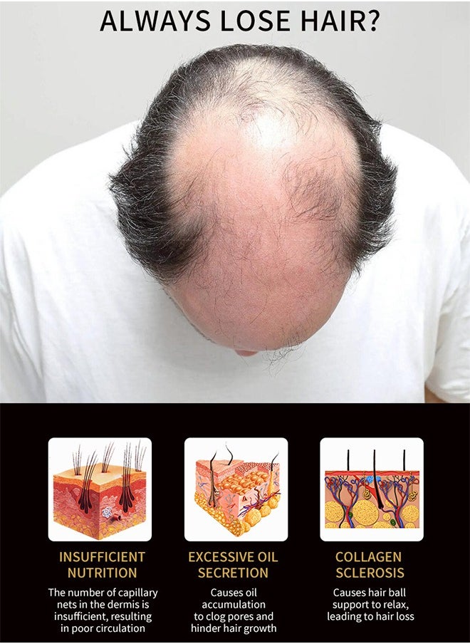 lansiyi - 20ml Hair Growth Essential Oil 5% Minoxidil and Biotin with Natural Herbal Extract for Women Men Hair Regrowth Hair Loss Hair Thinning Treatment - Image 1