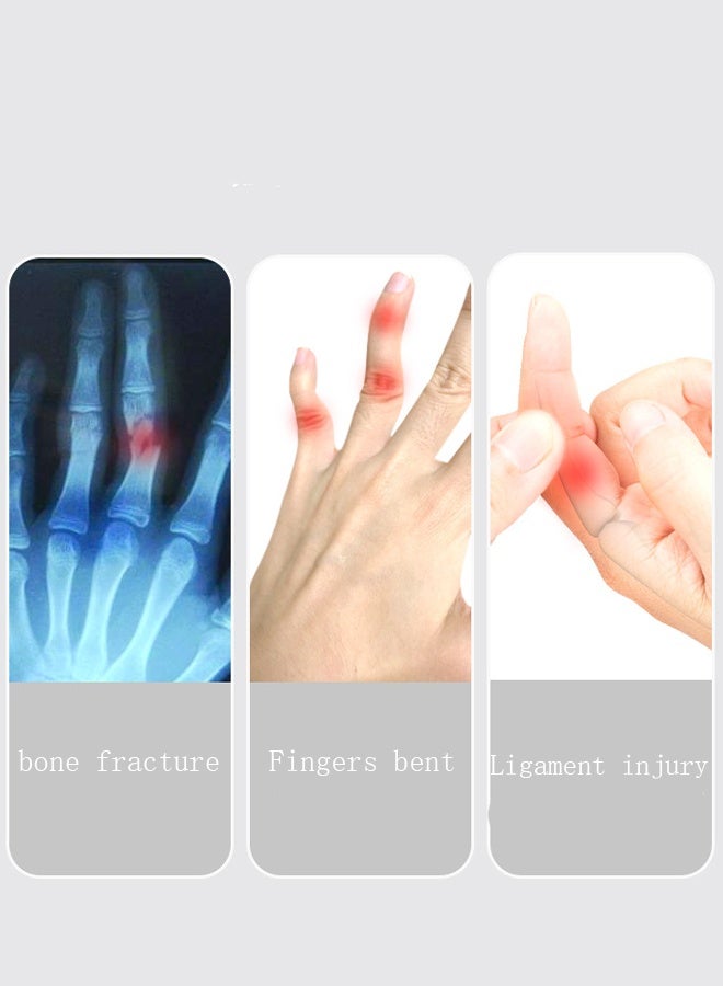 سيستار مثبت الأصابع، جبيرة، دعامة، دعامة تثبيت الكسر، جبيرة، غلاف إصبع لحماية إصابة المفصل المنحني (مقاس الأطفال) - Image 2
