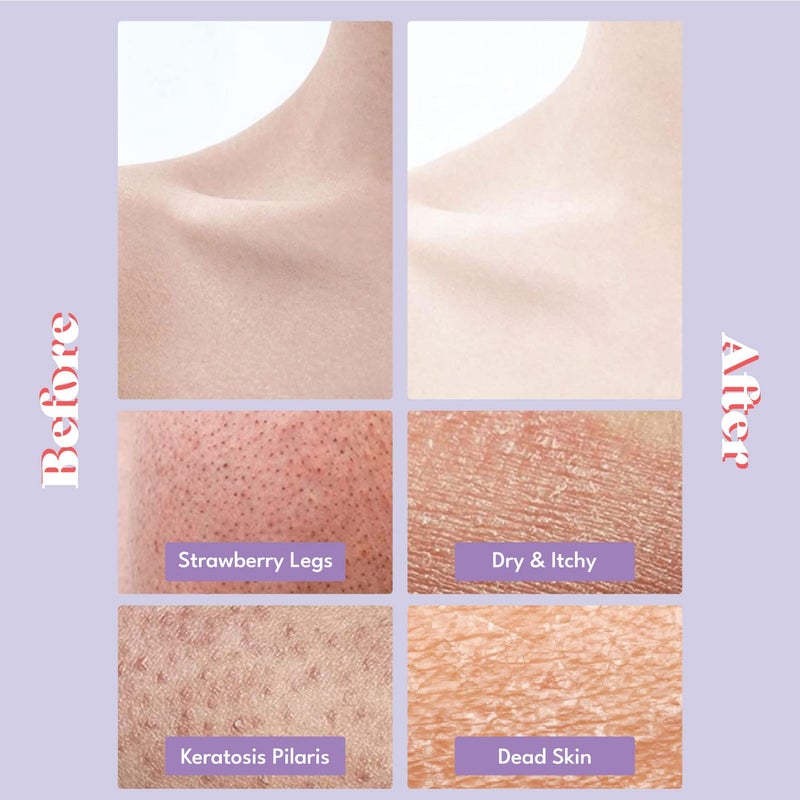 Toi:L Gentle Touch Bubble Peeling Body Pad(5pads), Body Scrub, Exfoliating Mitt for Body, Exfoliating Gloves, washcloth, Body loofah, Dense Bubble Bath, Bath Shower, kp Bump Eraser, Stocking Stuffer - Image 3