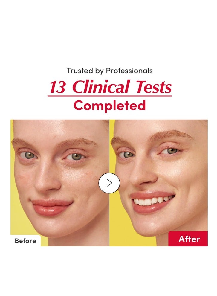 إيكوالبيري سيروم تفتيح البشرة من إيكوالبيري مع فيتامين سي: سيروم تفتيح البشرة مع الأسرولا والنياسيناميد، يقوي حاجز البشرة، يرطب البشرة مع السيراميد وحمض الهيالورونيك 30 مل / 1.01 أونصة - Image 5