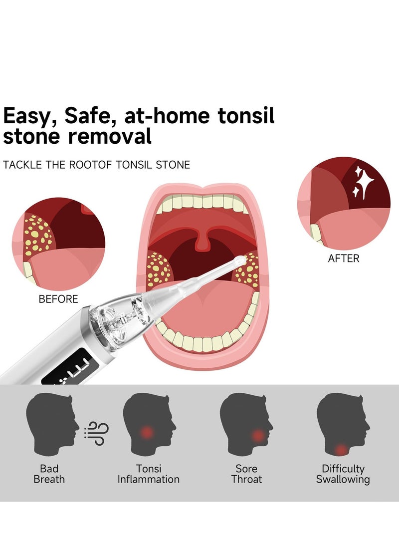 SYOSI Electronic Tonsil Stone Vacuum Remover, 3 Suction Modes with 5X Magnifying Mirror and 5 Silicone Nozzles, Tonsil Stone Removal Kit to Fight Bad Breath  - Image 2