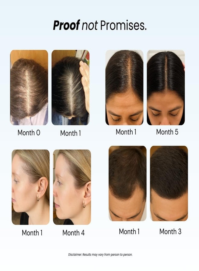 Growplex Revive Shampoo & Replenish Conditioner Bundle, Biotin Scalp Care System for Men & Women, Supports Fuller Thicker-Looking Hair Daily - Image 3