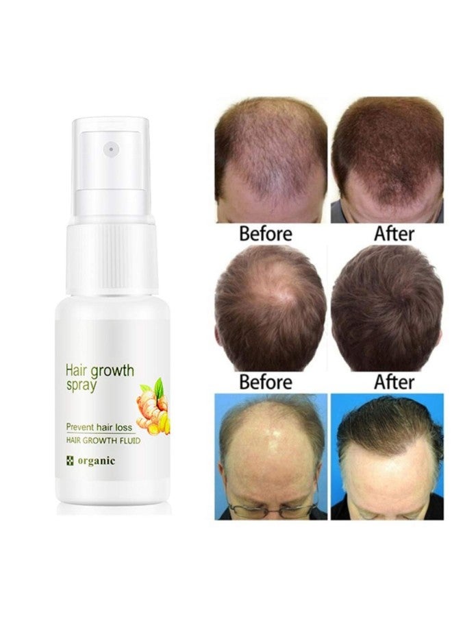 klarako Ginger Hair Growth Spray Prevent Hair Loss Nourishing Improve Hair Follicles Promote Hair Growth Spary for Men Women, 20ml - Image 3