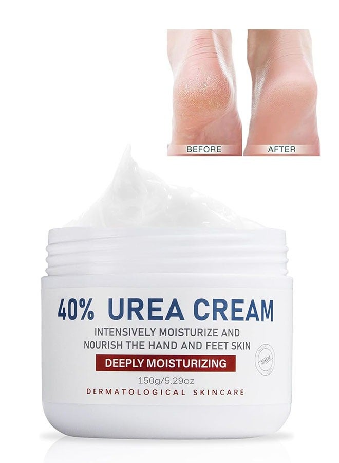 OUKEYA 40 Percent Urea Cream 150g, Intensively Moisturize And Nourish The Hand And Feet Skin, Urea Foot and Hand Cream for Dry Cracked - Image 1
