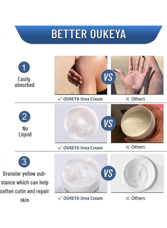 OUKEYA 40 Percent Urea Cream 150g, Intensively Moisturize And Nourish The Hand And Feet Skin, Urea Foot and Hand Cream for Dry Cracked - Image 4