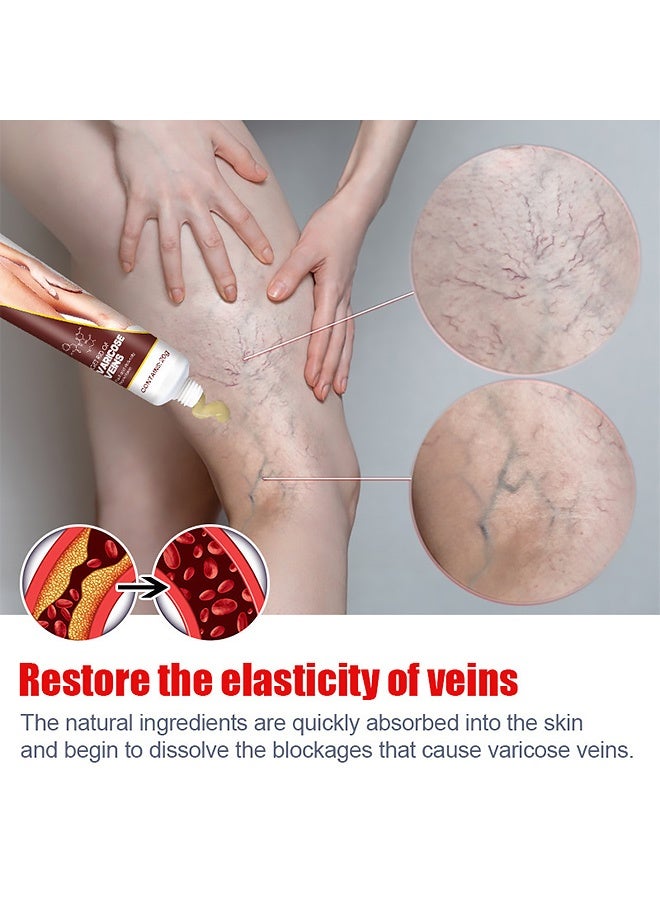 KanyeHB Varicose Veins Remove Cream 20g, Blood Circulation Vein Care Leg Cream, Vasculitis Phlebitis Foot Care Ointment, Pain Relief Therapy Firming Vein Lotion for Treatment of Varicose Veins - Image 3