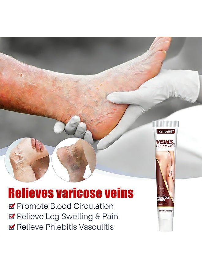 KanyeHB Varicose Veins Remove Cream 20g, Blood Circulation Vein Care Leg Cream, Vasculitis Phlebitis Foot Care Ointment, Pain Relief Therapy Firming Vein Lotion for Treatment of Varicose Veins - Image 2