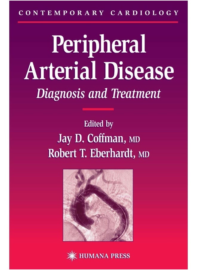 Peripheral Arterial Disease: Diagnosis and Treatment 
