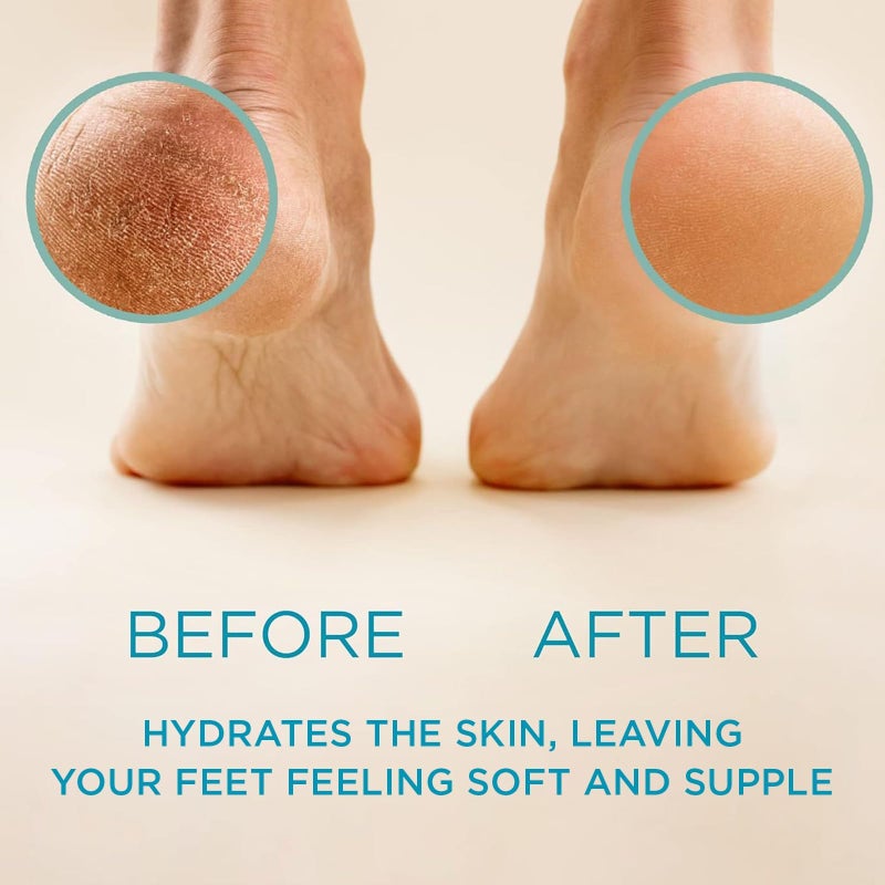 Lee Beauty Professional أفضل مزيل للجلد الميت، مزيل للجلد القاسي، سائل وهلام للجلد القاسي والقرون على القدمين - Image 2