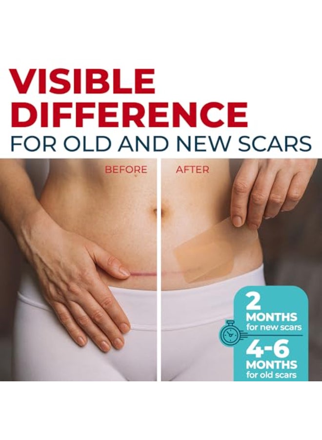 MYHELP Medical Grade Silicone Scar Sheets 6pk 57x16 Visible Difference on Surgical Keloid Marks Reusable CSection Scar Silicone Strips Easy to Use Strips - Image 3