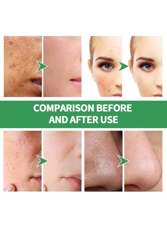 HUNMUI Centella Foam Face Mask, Centella Asiatica Bubble Face Mask, Wrinkle Removal, Moisturising, Deep Cleansing Smear Skin Care, Removes Black Spots and Controls Oil (1) - Image 2
