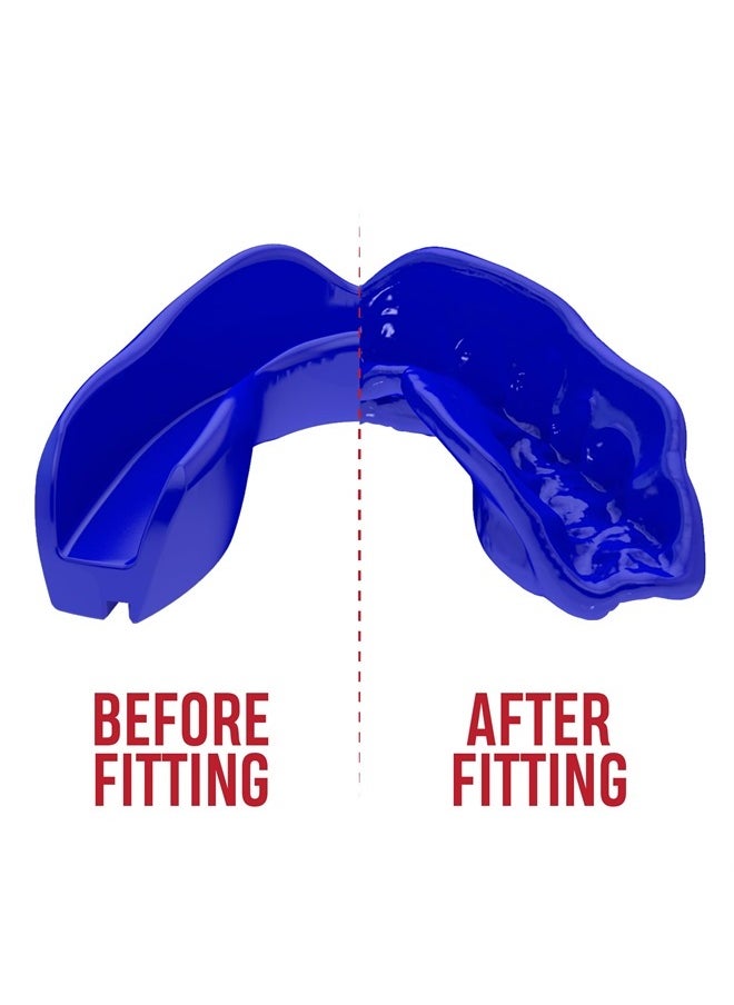SAFEJAWZ Mouthguard Slim Fit, Adults and Junior Mouth Guard with Case for Boxing, Basketball, Lacrosse, Football, MMA, Martial Arts, Hockey and All Contact Sports (Blue, Adult)  - Image 4